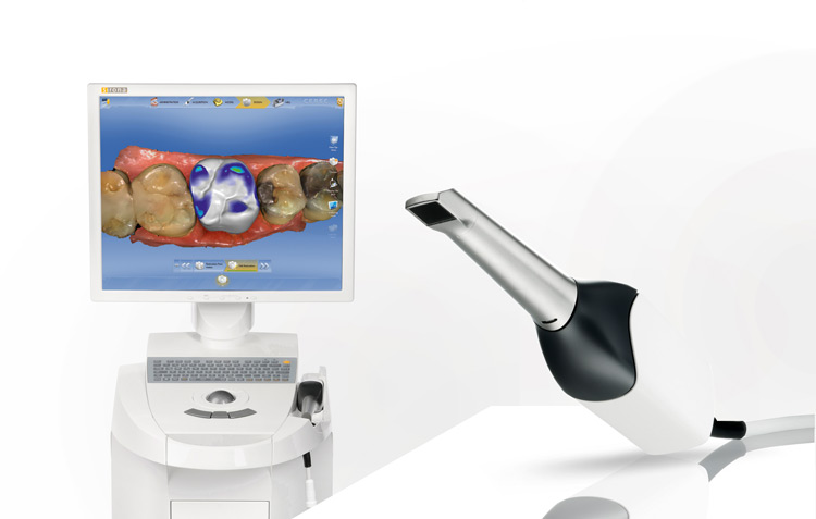 pic-main-cerec